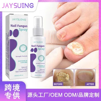 Jaysuing Nail Fungus Spray 100ml