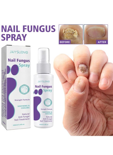 Jaysuing Nail Fungus Spray 100ml